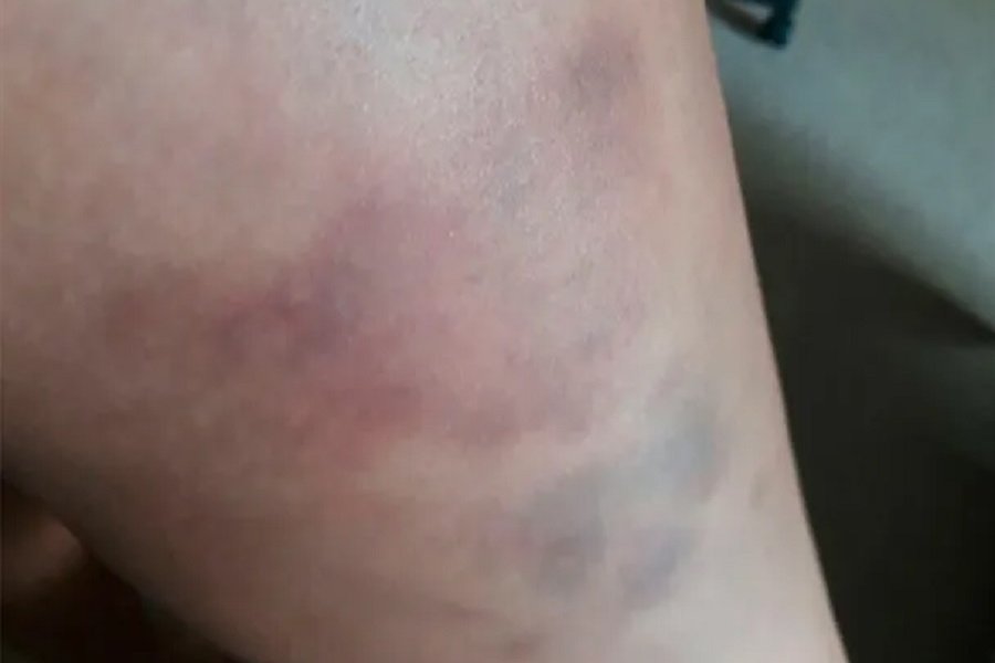 La víctima denunció al agresor La víctima denunció al agresor