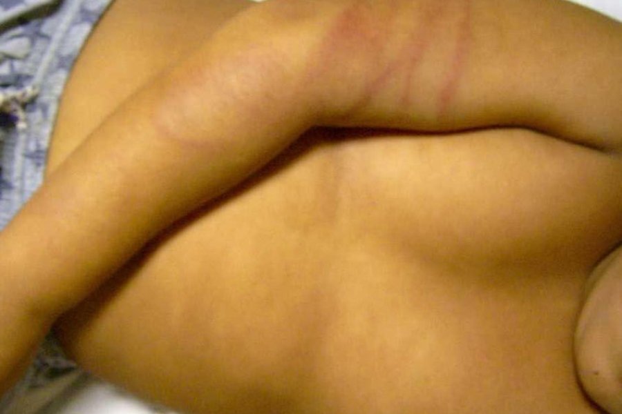 Presenta múltiples heridas. Presenta múltiples heridas.