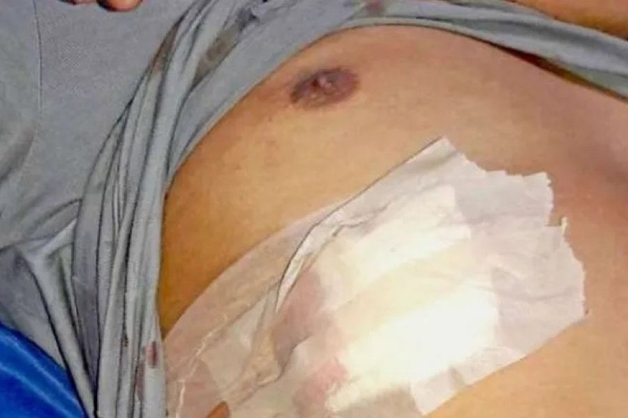 Fue internado en el Regional. Fue internado en el Regional.
