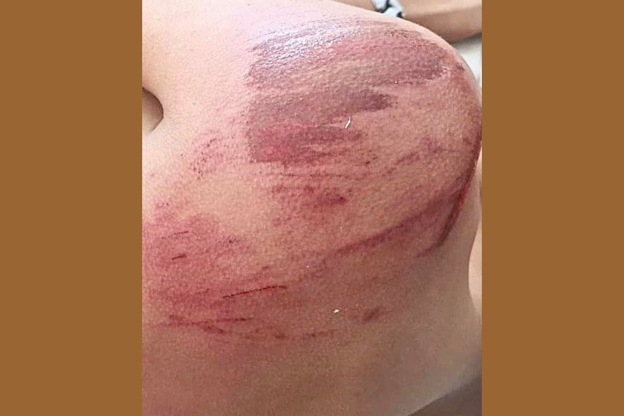 La víctima radicó la denuncia penal. La víctima radicó la denuncia penal.