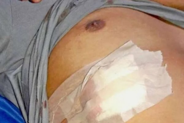 Escuchó ruidos con su madre, salieron a ver y fue acuchillado en el abdomen