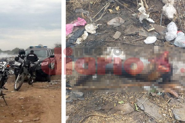 Le amputaron las piernas tras un accidente y las arrojaron a un basural